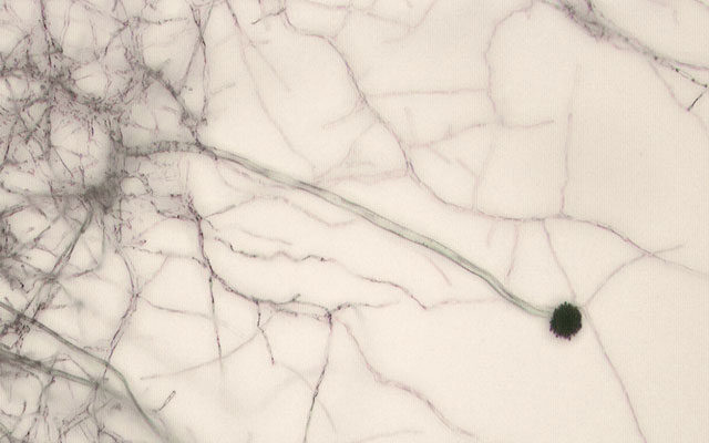 Deadly Fungal Infections Rising Amid Climate and Resistance